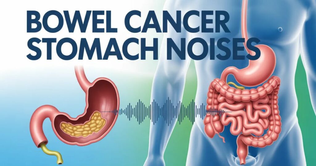 bowel cancer stomach noises